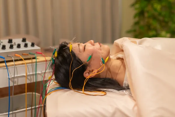 電気美容鍼の治療風景