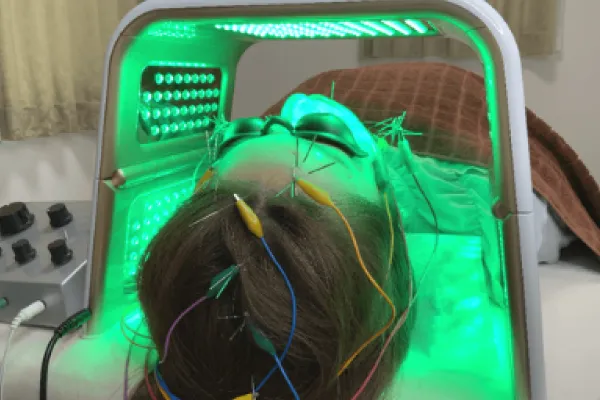 緑色LEDを使用した電気を流す美容鍼